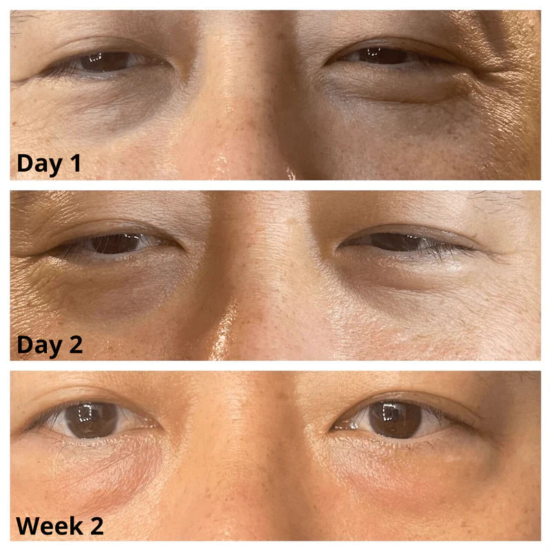 Korean Caffeine Eye Cream