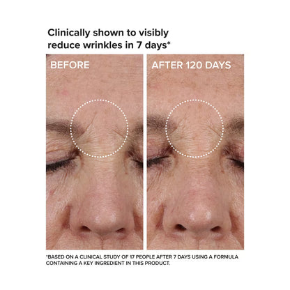 Needle-Less Growth Factor Serum