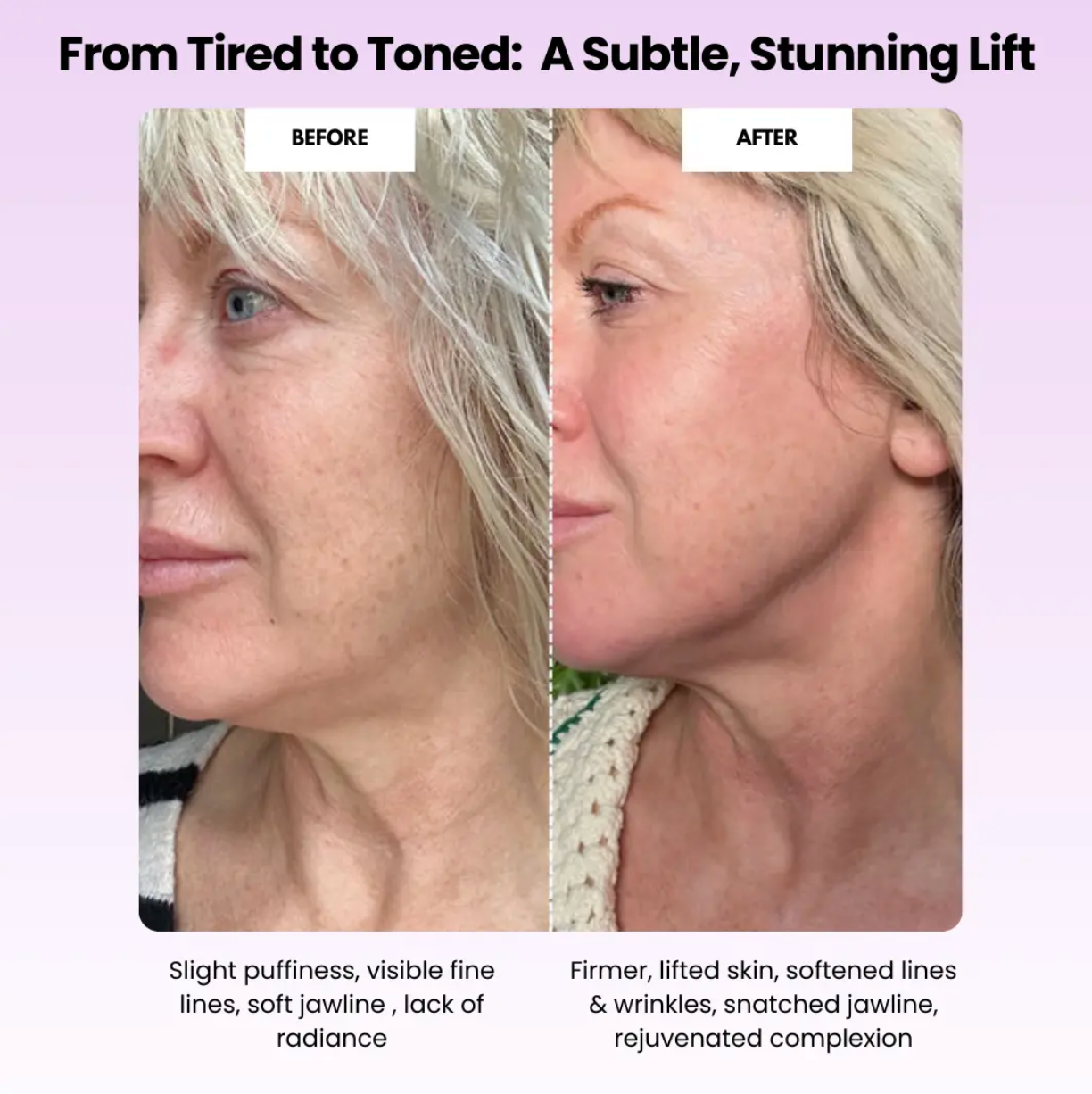 Sculptr™ Lymphatic Drainage Roller