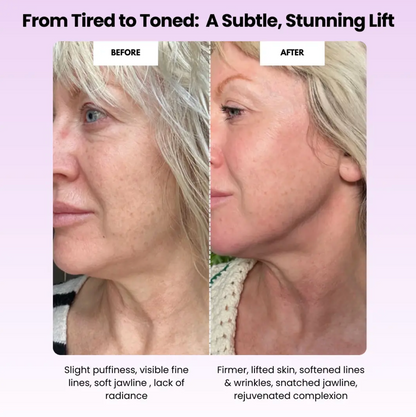 Sculptr™ Lymphatic Drainage Roller