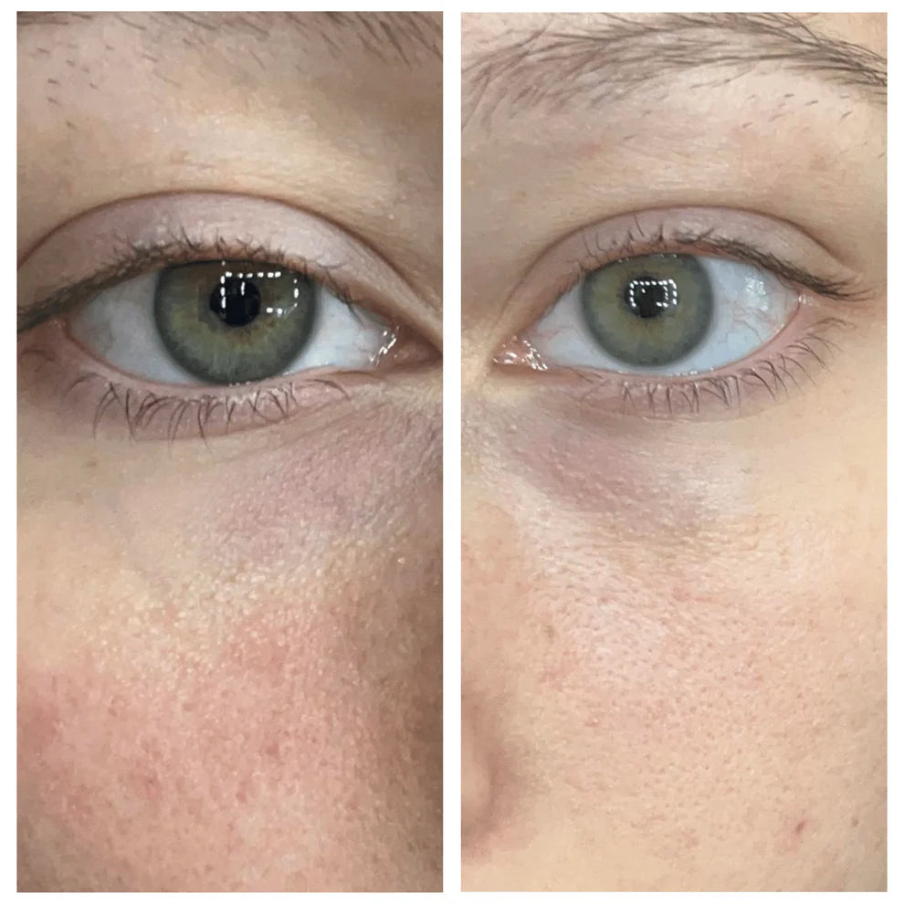 Korean Caffeine Eye Cream