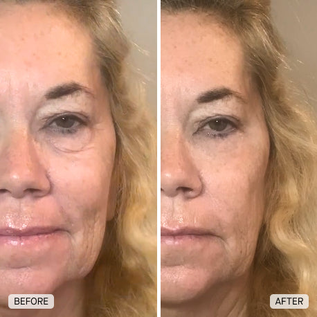 Customer skin appearance results