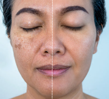 Korean Glutathione 7 Dark Spot Erasing Serum Patches