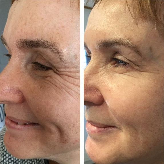 Before and after skin appearance comparison